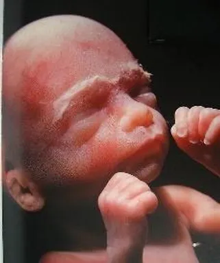 Photo of a foetus in utero