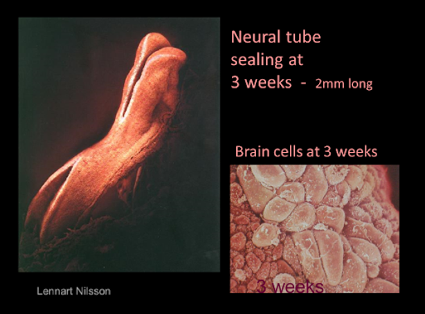 Electron microscope photo of neural tube sealing at 3 weeks and brain cells at 3 weeks